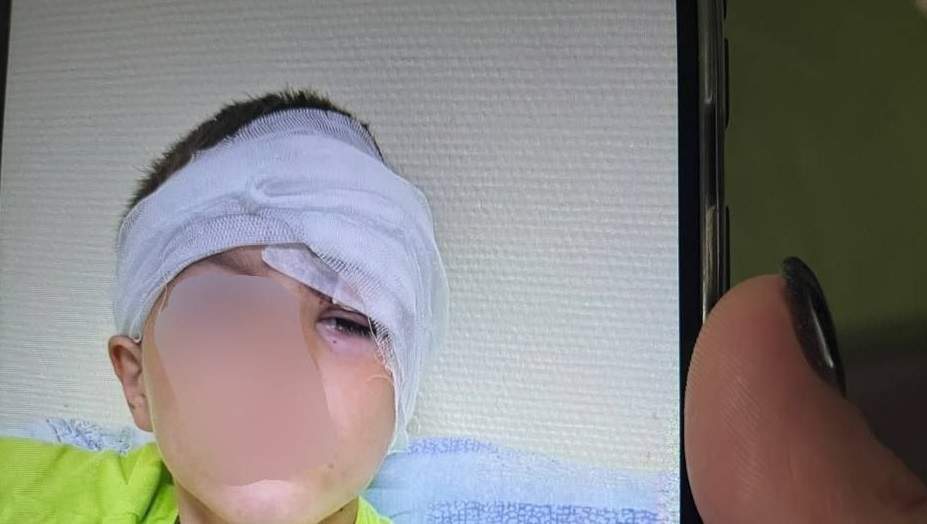Бездомная собака изуродовала ребёнка в Надеждинском районе