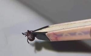 Кадр с видео: в Уссурийске мужчина нашёл клеща